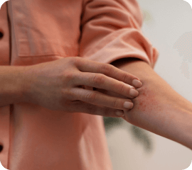 skin rash