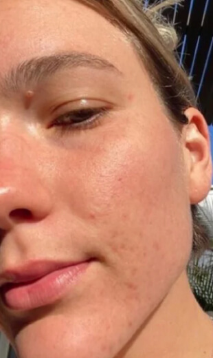 skin after cleanse