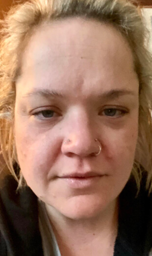 before detox fatigue